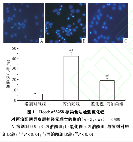 Hoechst33258ȾɫzyȻ䇌TƤ(jng)ԪӰ